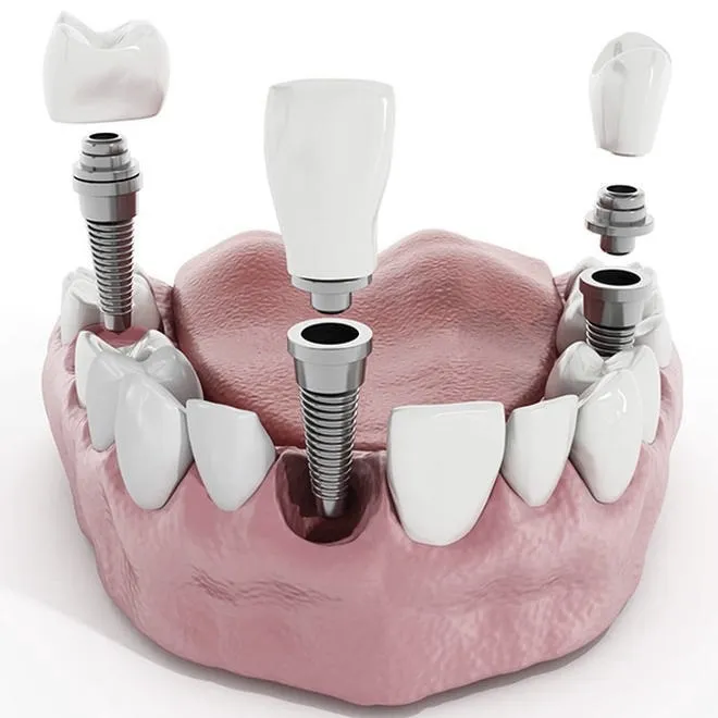 Ile zarabia protetyk dentystyczny? Odkryj sekrety dochodowego zawodu!